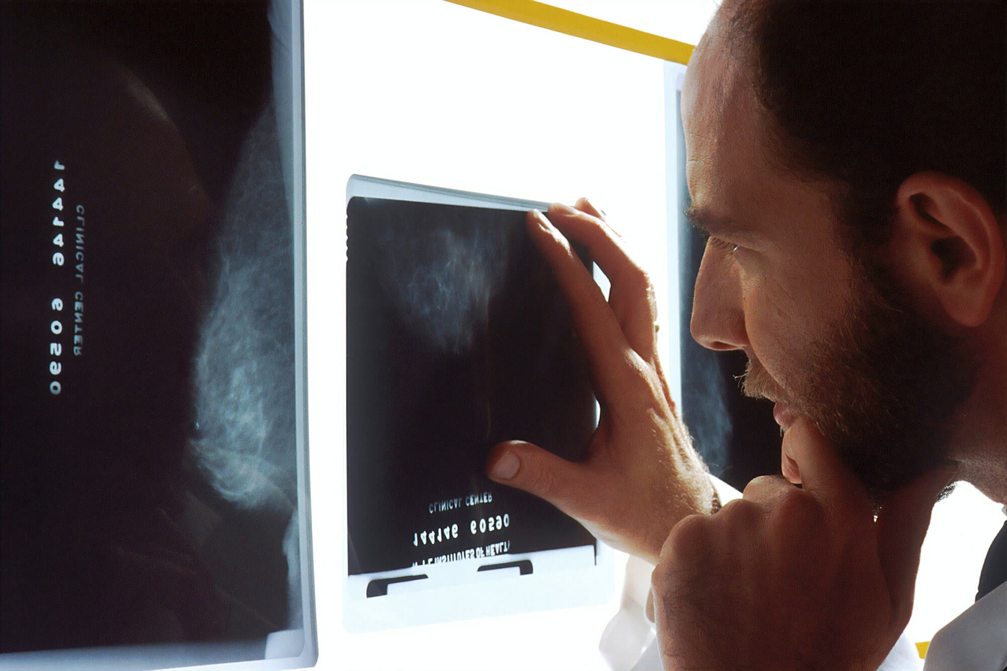 La radiologie passée au scanner !